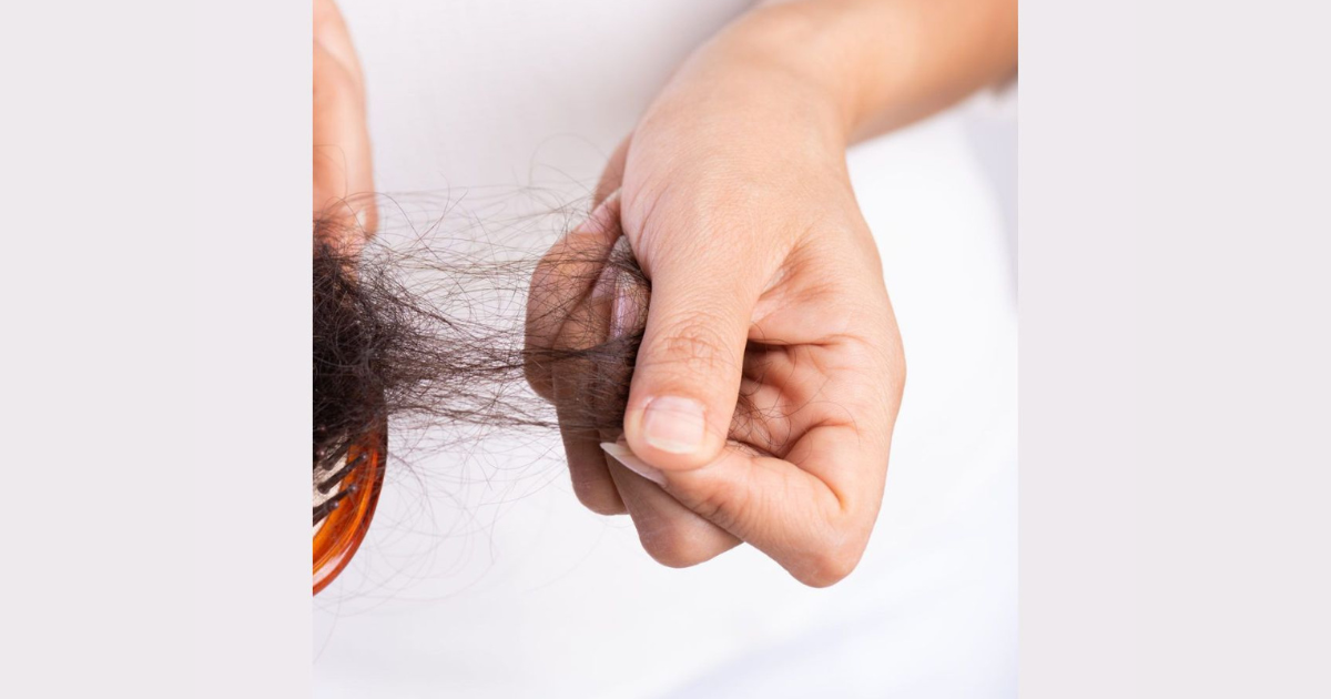 Causes of Hair Loss, Homeopathic Remedies for Hair fall